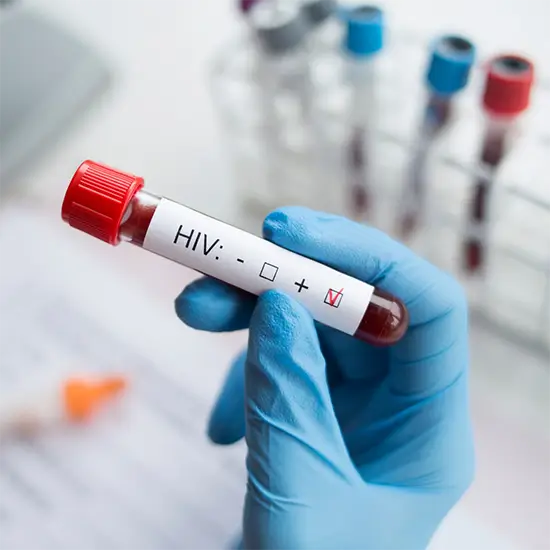 HIV 1 and 2 Antibody Screening